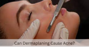 Can Dermaplaning Cause Acne?