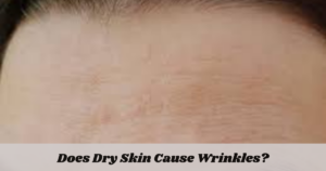 Does Dry Skin Cause Wrinkles?