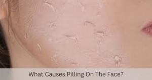 What Causes Pilling On The Face?
