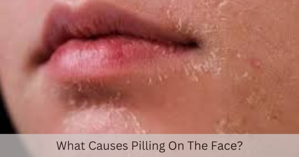 what causes pilling on face?